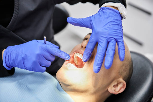 Best Emergency Dental Care for Abscessed Tooth in Lackland Af, TX