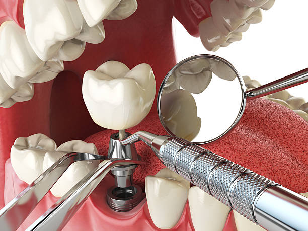Best Broken or Cracked Tooth Emergency Dentist in Lackland Af, TX